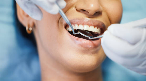 Best Emergency Dental Care for Broken or Chipped Teeth in Ionia, MI