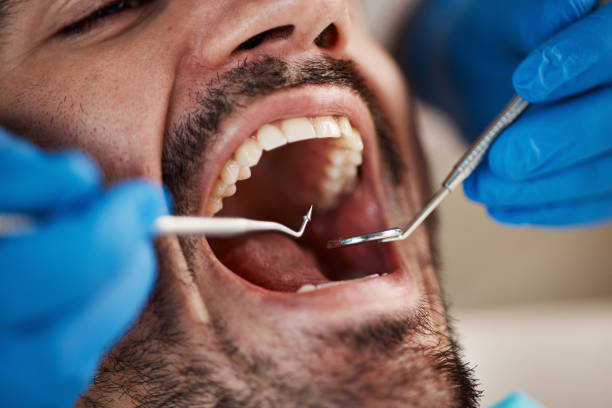 Best Emergency Treatment for Dental Infections or Abscesses in Ionia, MI
